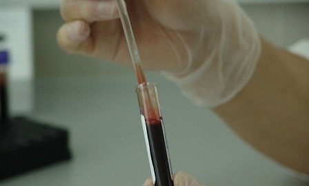 Hospital caught faking blood tests in apparent insurance scam