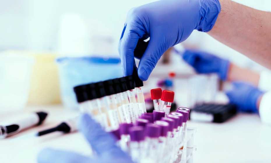What’s the best kind of test for drug screening?